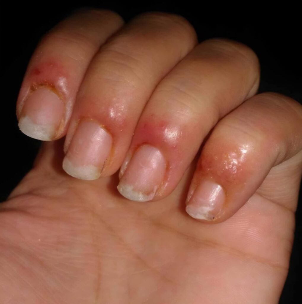 bebeauty-kristiansand-Allergier